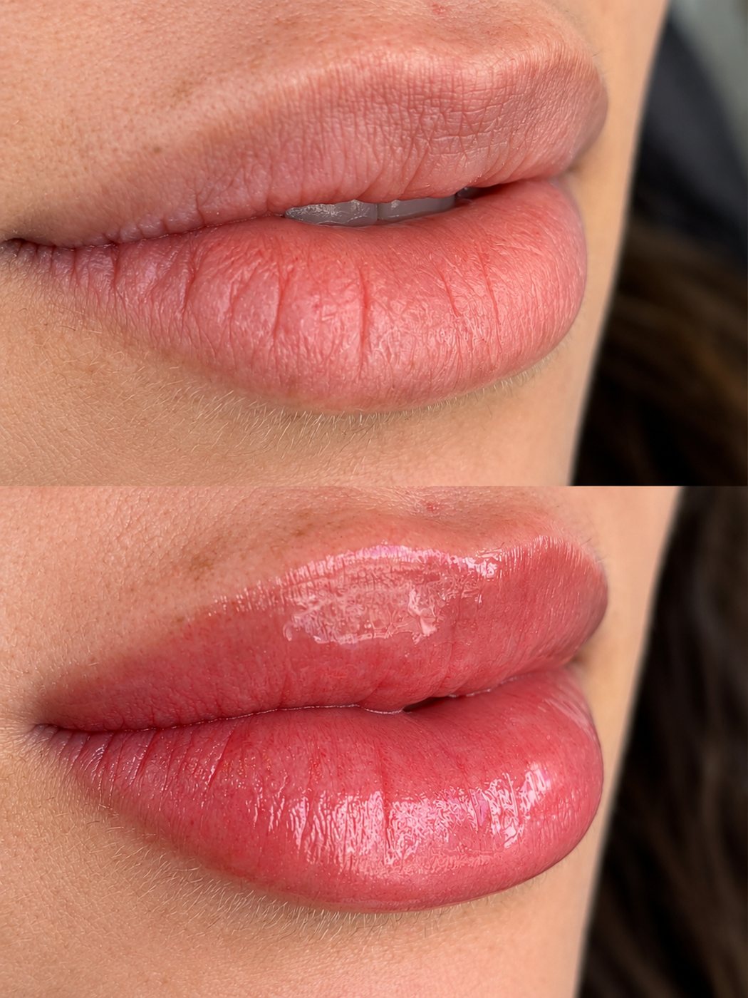 Lábios antes (em cima) e depois da micropigmentação labial (embaixo)